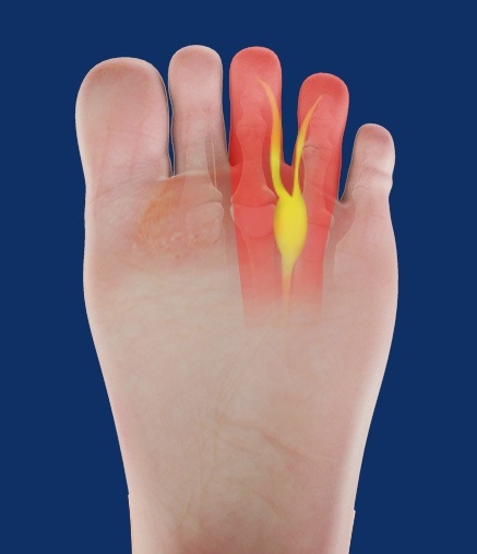 Kinetic Neuro Rehab Deva - Neuromul Morton
